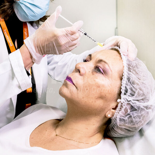 toxina-botulinica-sanasalud