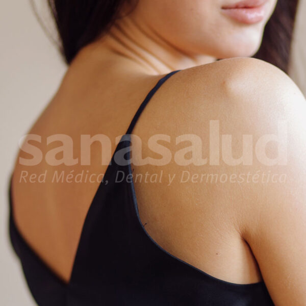 microdermoabrasion-espalda